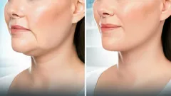 5 exerciții simple care conferă un aspect „întins” al feței fără a apela la un cosmetolog — deja după câteva săptămâni